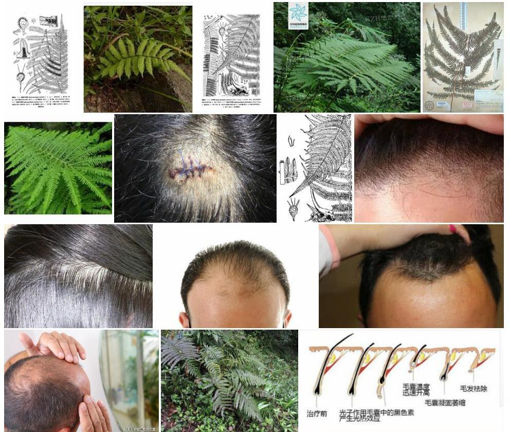 毛囊方秆蕨照片和图片/