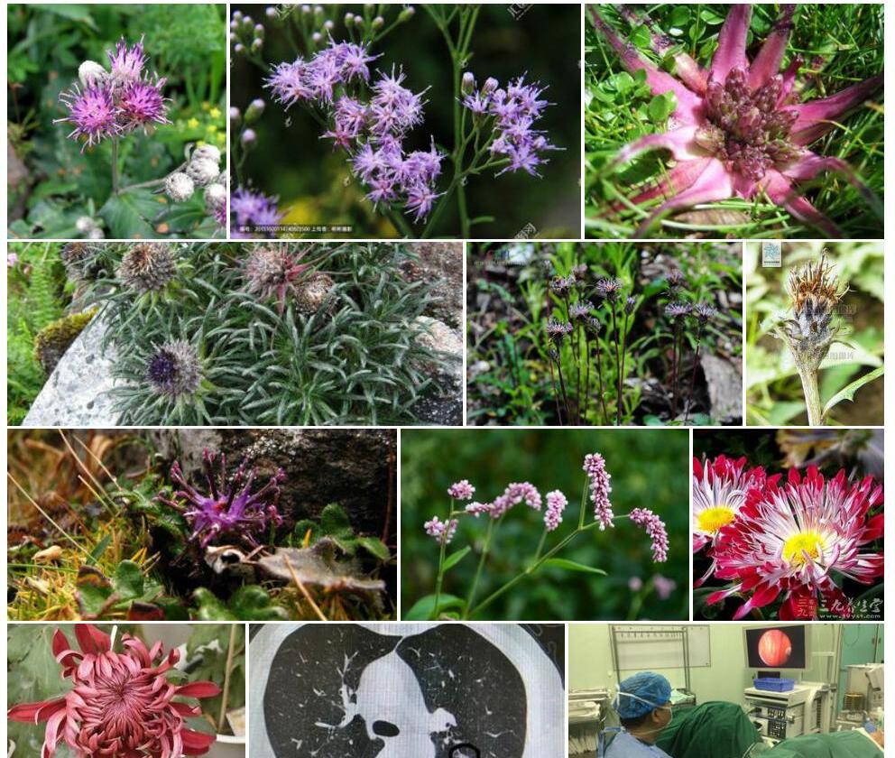 滇风毛菊照片和图片/