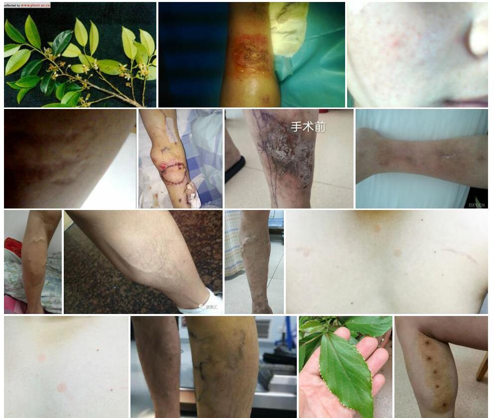 隐脉红淡比照片和图片/